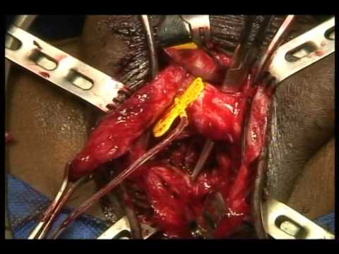 how to repair ureteral injuries