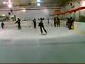 Scissor Brake Beta 2