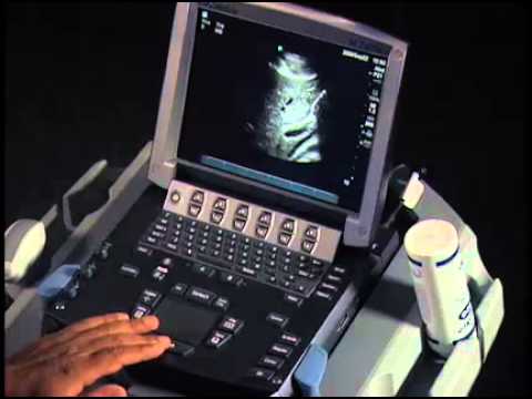 how to locate cbd on ultrasound