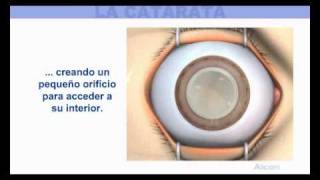 Miguel March Balle-13
