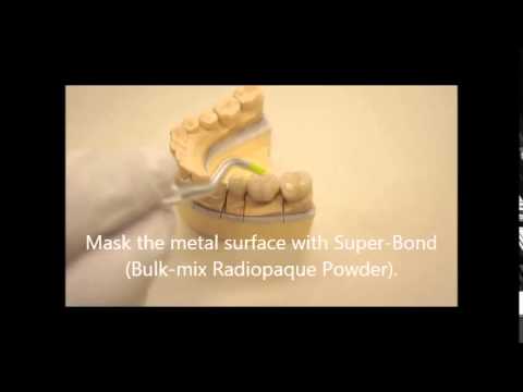 how to repair pfm crown