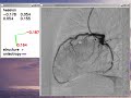 Vessel detection on digital images