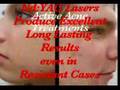 rosacea and acne treatmnet in teenagers