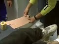 Prevention and Treatment Of Sports Injuries part 2 Prevention and Treatment Of Sports Injuries part 2