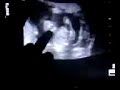 gravidanza italia ferrarelle show batte mani clap hands