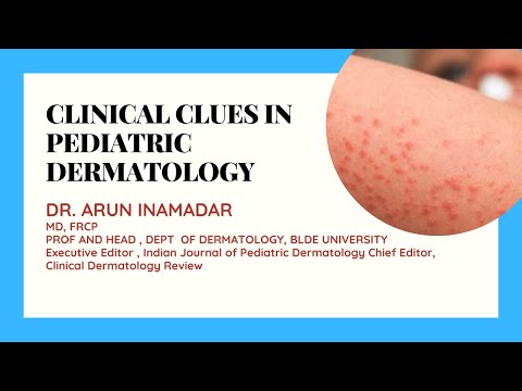 CLINICAL CLUES IN PEDIATRIC DERMATOLOGY | Dr. Arun Inamadar