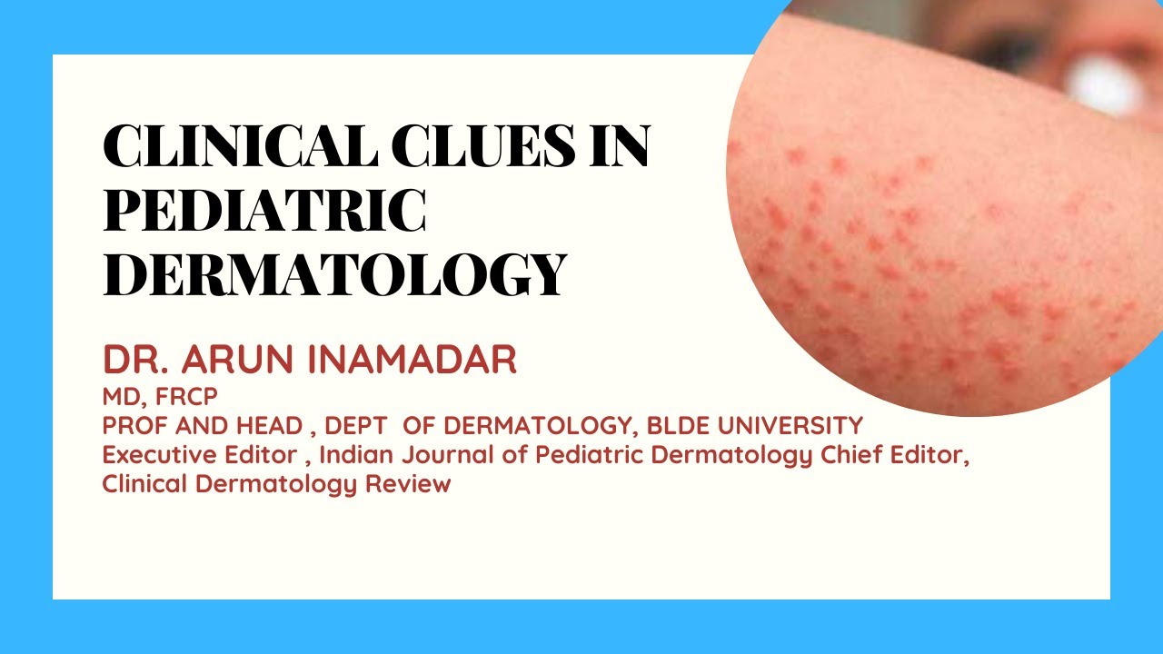CLINICAL CLUES IN PEDIATRIC DERMATOLOGY | Dr. Arun Inamadar