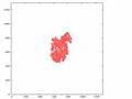 Simulation of cancer growth 2