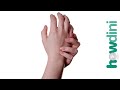How to treat a burn - How to treat burns at home