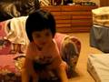 3 year old with Arthrogryposis