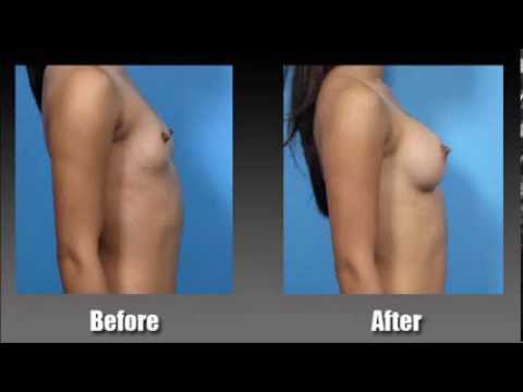 how to grow bigger breasts
