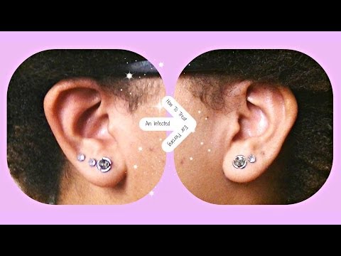 how to get rid ear infection