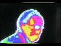 Thermography, thermal imaging or thermal video is a type of infrared imaging. Thermographic cameras detect radiation in the infrared range of the electromagnetic spectrum (roughly 900--14000 nanometers or 0.9--14 µm) and produce images of that radiation. Since infrared radiation is emitted by all objects based on their temperatures, according to the black body radiation law, thermography makes it possible to 