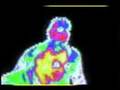 Thermography
