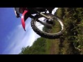 Motomaniax jake Breaking his wrist