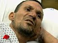 Migrants Turn to Cannibalism to Survive