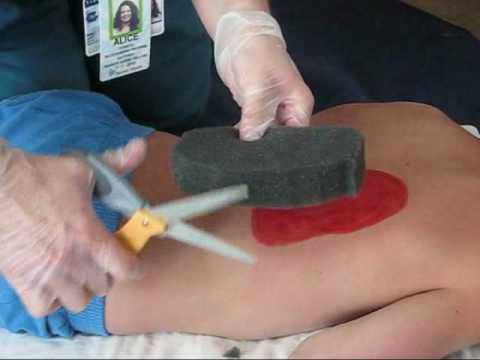 Wound Vac Demonstration