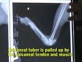 Radiography (X-rays)