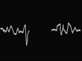 - Hipno Electro - - Hipno Electro - - Hipno Electro -