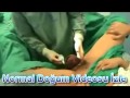 Normal Doğum Videosu İzle