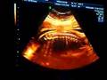 my baby pocho j.r