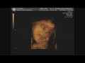 Little Baby Gray: 29 Weeks Part 3