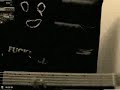 \"The Bankrupt Bassplayer\" Part 1 \"The Bankrupt Bassplayer\" Part 1