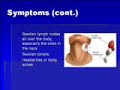 Matt Bessesen MONONUCLEOSIS