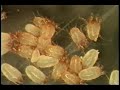 Dr. Philip Tierno talks about what's living in your pillows