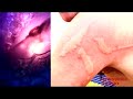Plagas de medusas, ¿cómo actuar? Plagas de medusas, ¿cómo actuar?