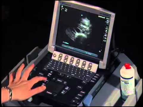 how to measure aorta on ultrasound