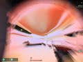 Atom Bomb