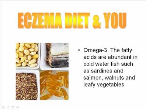 how to help eczema with diet