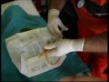 Sondaje Vesical