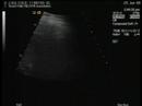 this is the dvd made of the ultrasound we did last wednesday.