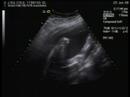 this is the dvd made of the ultrasound we did last wednesday.