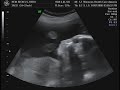 Baby Rickels