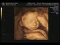 videos de Baby Rickels
