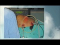 Click here to watch this video Laparoscopic Training Batch May 2012 Centre of Excellence in Laparoscopy