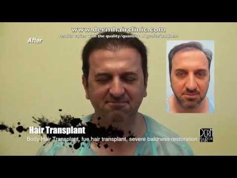 how to repair hair follicles