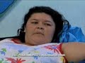 Cirurgia Bariátrica SES-DF (Balanço Geral) Cirurgia Bariátrica SES-DF (Balanço Geral)
