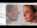 3D Visual Treatment Objective (VTO) Software Demo