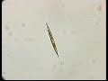 EUGLENA ACUS.