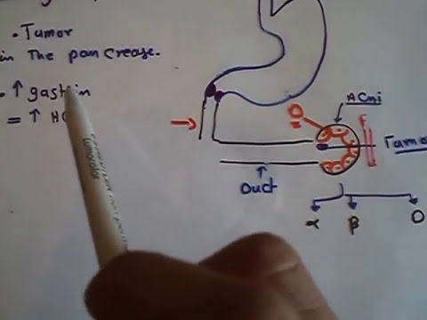 how to treat zollinger-ellison syndrome