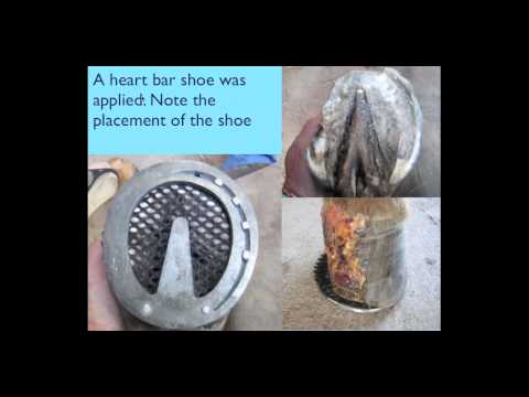 how to treat avulsion
