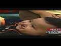 KENS5 with Dr. Tim Hensen - Cleft lip/palate - UTHSCSA