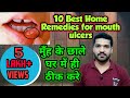 Download मुँह के छालों के 10 घरेलु इलाज How To Treat Mouth Ulcers At Home Mp3 Song