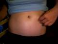 First egg donor lupron, follistim, menopur shots pt1