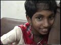 Transcendental Meditation - Cured Cases Of Leucoderma, Vitiligo, Frigh, Bedwetting.