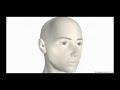 Sinusitis Pathology (Para-nasal Sinus Anatomy)